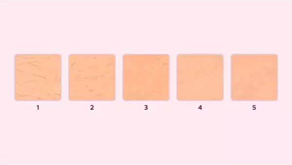 lumea 2 Philips Lumea IPL Hair Removal Device BRI944/00