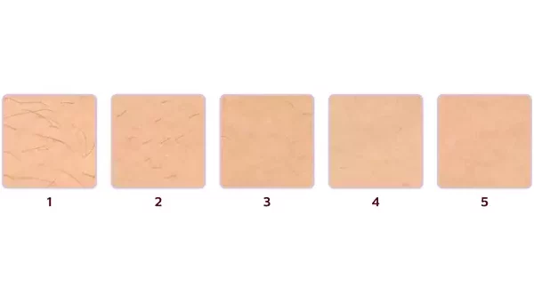 lumea 949 13 Philips Lumea Prestige IPL Hair Removal Device BRI949